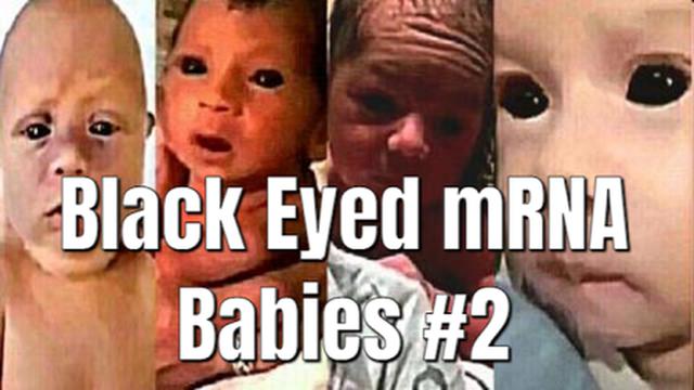 Black Eyed mRNA Babies #2