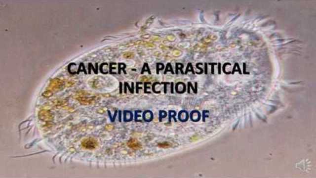 VIDEO PROOF: CANCER IS CAUSED BY PARASITES