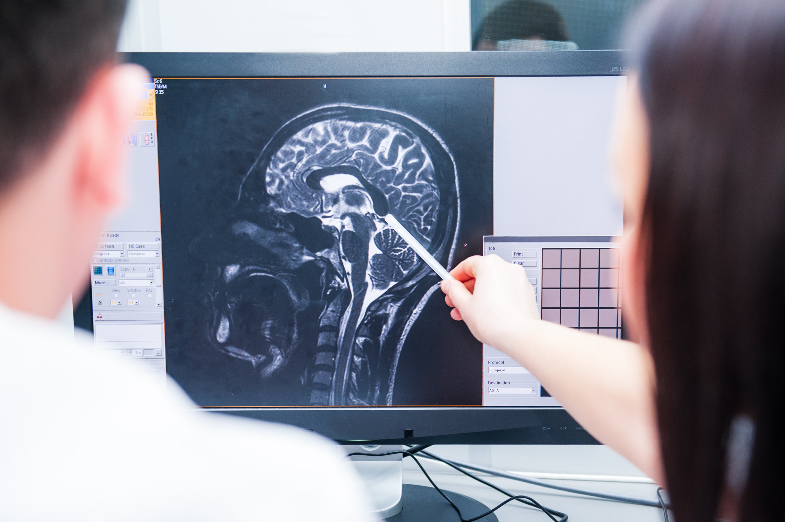 Alcohol shrinks the brain: Even one glass a day can cause significant damage, study warns - Study Finds