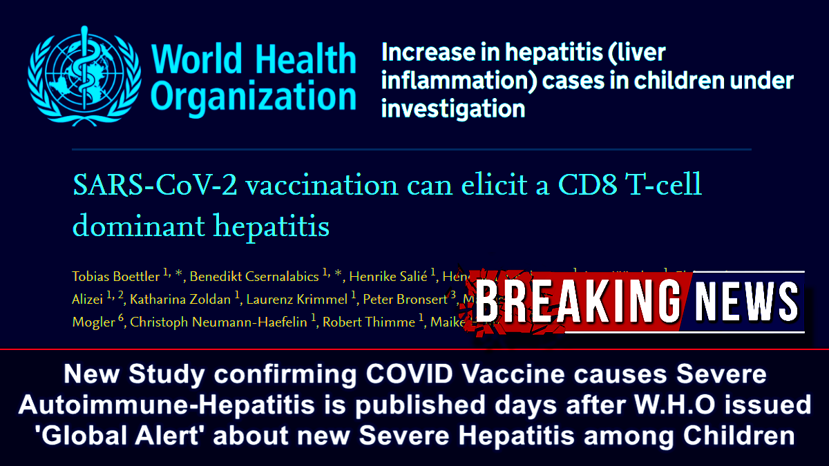 New Study confirming COVID Vaccine causes Severe Autoimmune-Hepatitis is published days after W.H.O issued Global Alert about new Severe Hepatitis among Children  The Expose