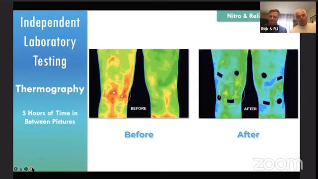 Laboratory Thermography Testing 5 Hours after using Nitro and Relief Patches
