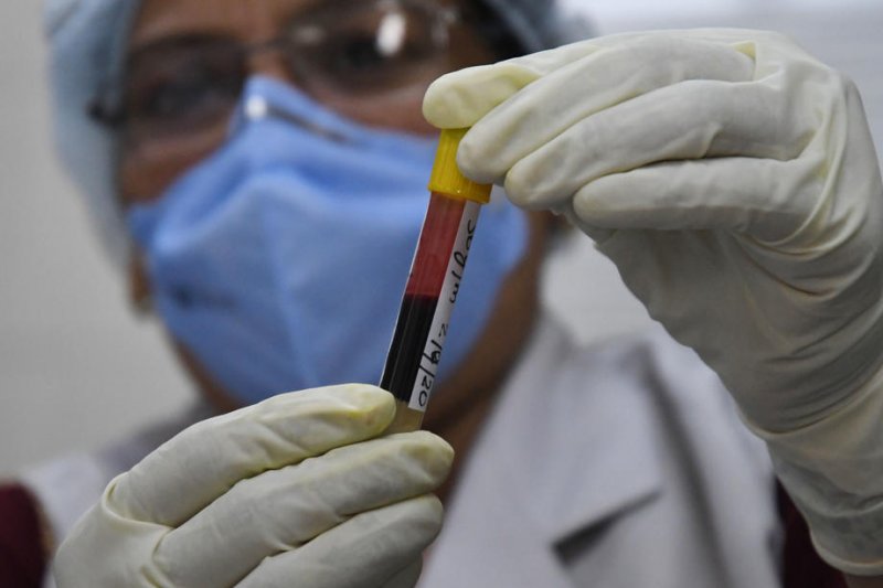 Study: COVID-19 patients at increased risk for serious blood clots up to six months after infection - UPI.com