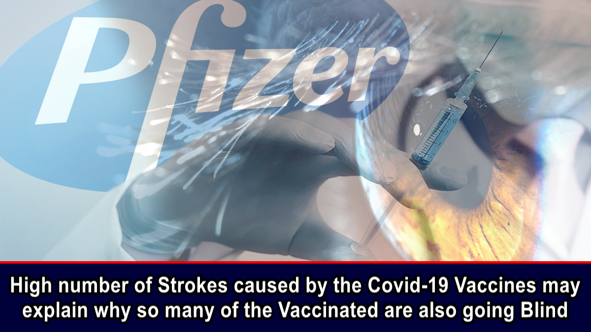 High number of Strokes caused by the Covid-19 Vaccines may explain why so many of the Vaccinated are also going Blind – The Expose