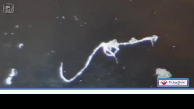 Dr Jane Ruby - Worms And Worm Eggs Confirmed, Parasites In All Vials! (3-7-2022)