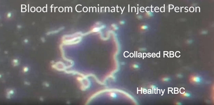 No parasites in the jab! It's something else...