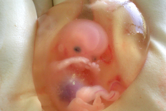 Abortion industry pushing chemical pill to starve unborn in womb as fears rise SCOTUS will overturn Roe v. Wade – NaturalNews.com