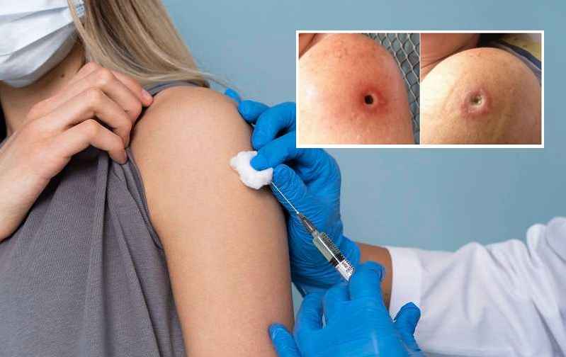Weer een verschrikkelijke "vaccin" bijwerking: Kankerachtige tumoren op de injectieplaats - Frontnieuws