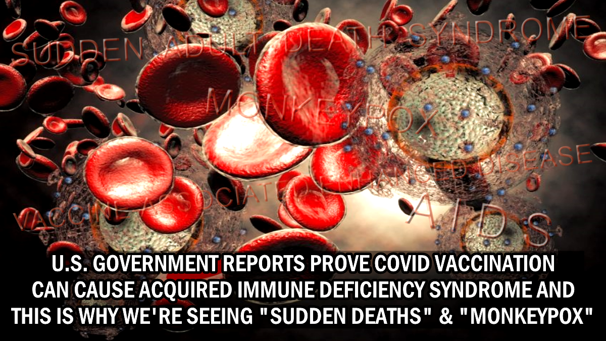 U.S. Gov. reports prove COVID Vaccination can cause Acquired Immune Deficiency Syndrome & this is why we’re seeing “Sudden Deaths” & “Monkeypox”… – The Expose