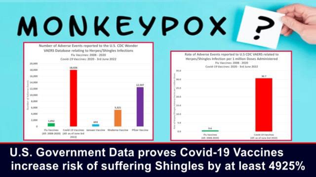 Monkeypox Renamed for Shingles? COVID-19 Vaccines Increase Risk of Shingles by 4,925%