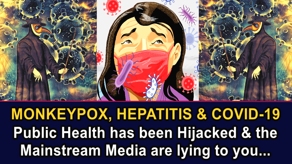 Monkeypox, Hepatitis & Covid-19: Public Health has been Hijacked & the Mainstream Media are lying to you… – The Expose