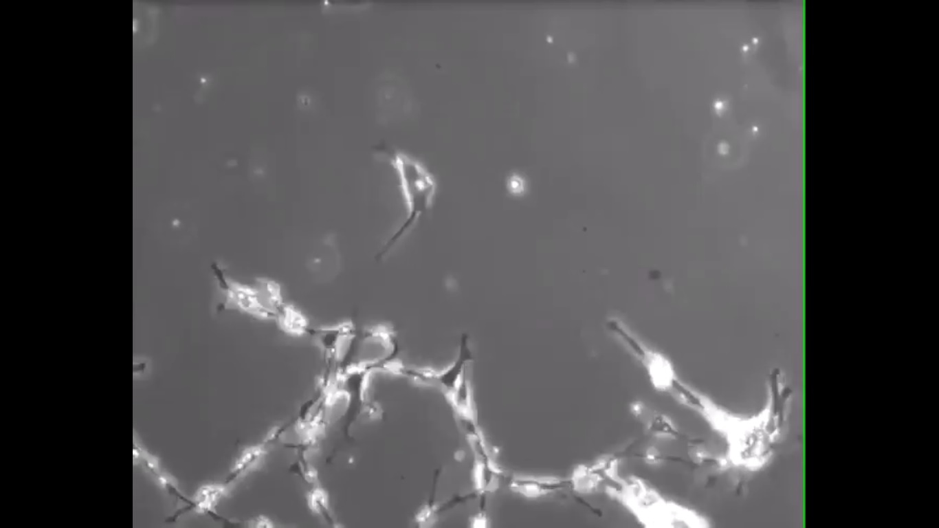Nanoparticles can form structures, including clots – World-Signals News