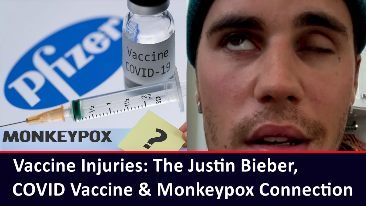 Vaccine Injuries: The Justin Bieber, COVID Vaccine & Monkeypox Connection – The Expose