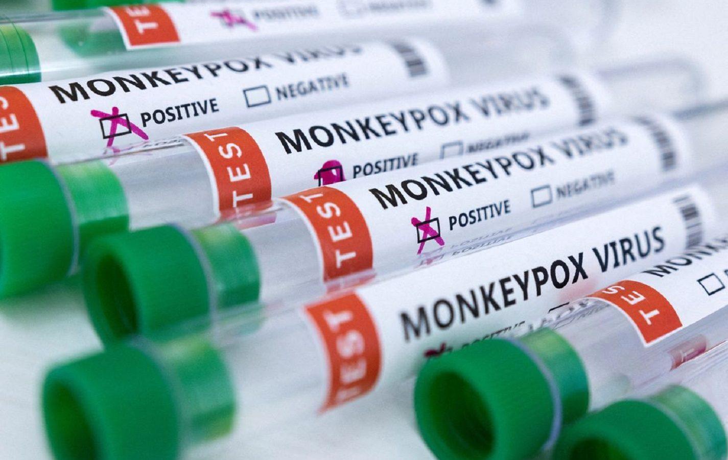 Monkeypox is Following the COVID Playbook Step by Step