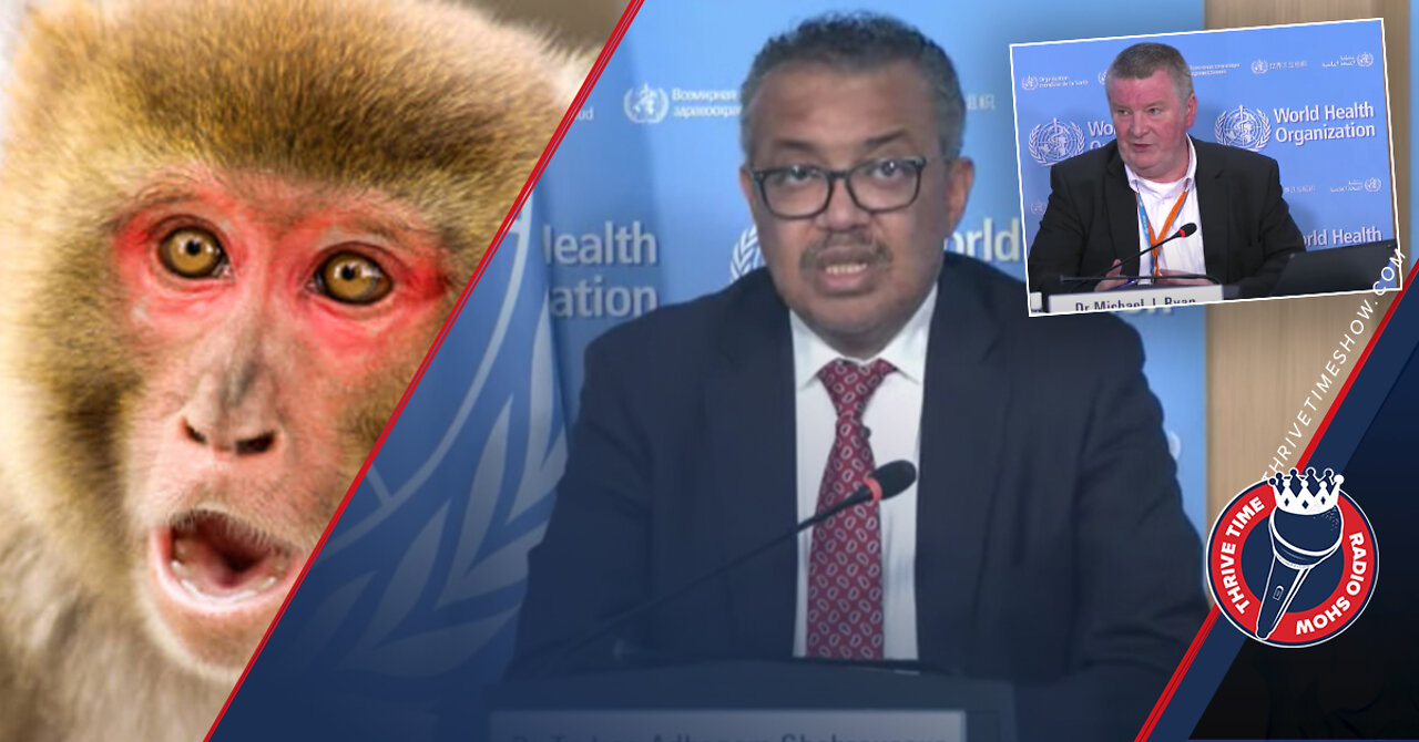 Monkeypox |