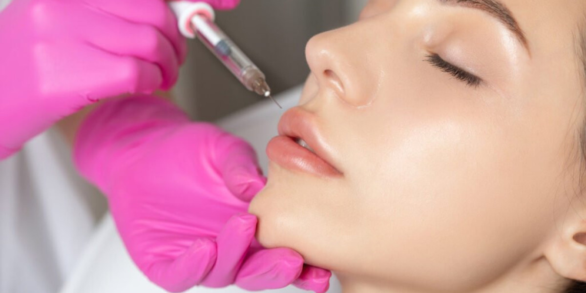 Enhance Your Smile with Dubai Lip Fillers: A Touch of Elegance