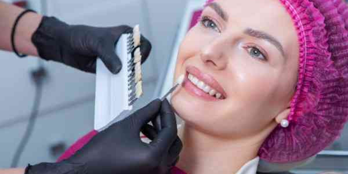 Your Guide to Local Smile Services in Nottingham